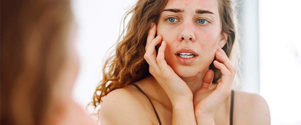 Mujer trata sus problemas de irritación e inflamación con ácido salicílico BHA