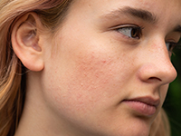 El aceite de aguacate es antioxidante y antiinflamatorio