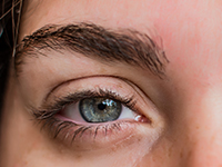 Picor y rojez en las cejas por causa de la dermatitis seborreica